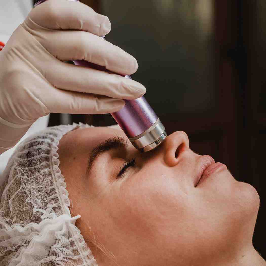 Dermatologists for Acne Treatment